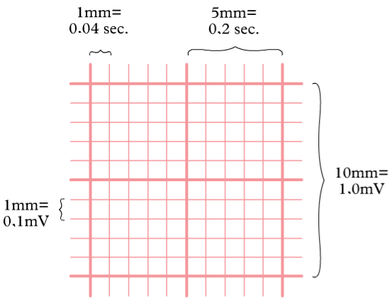 ECG scaling